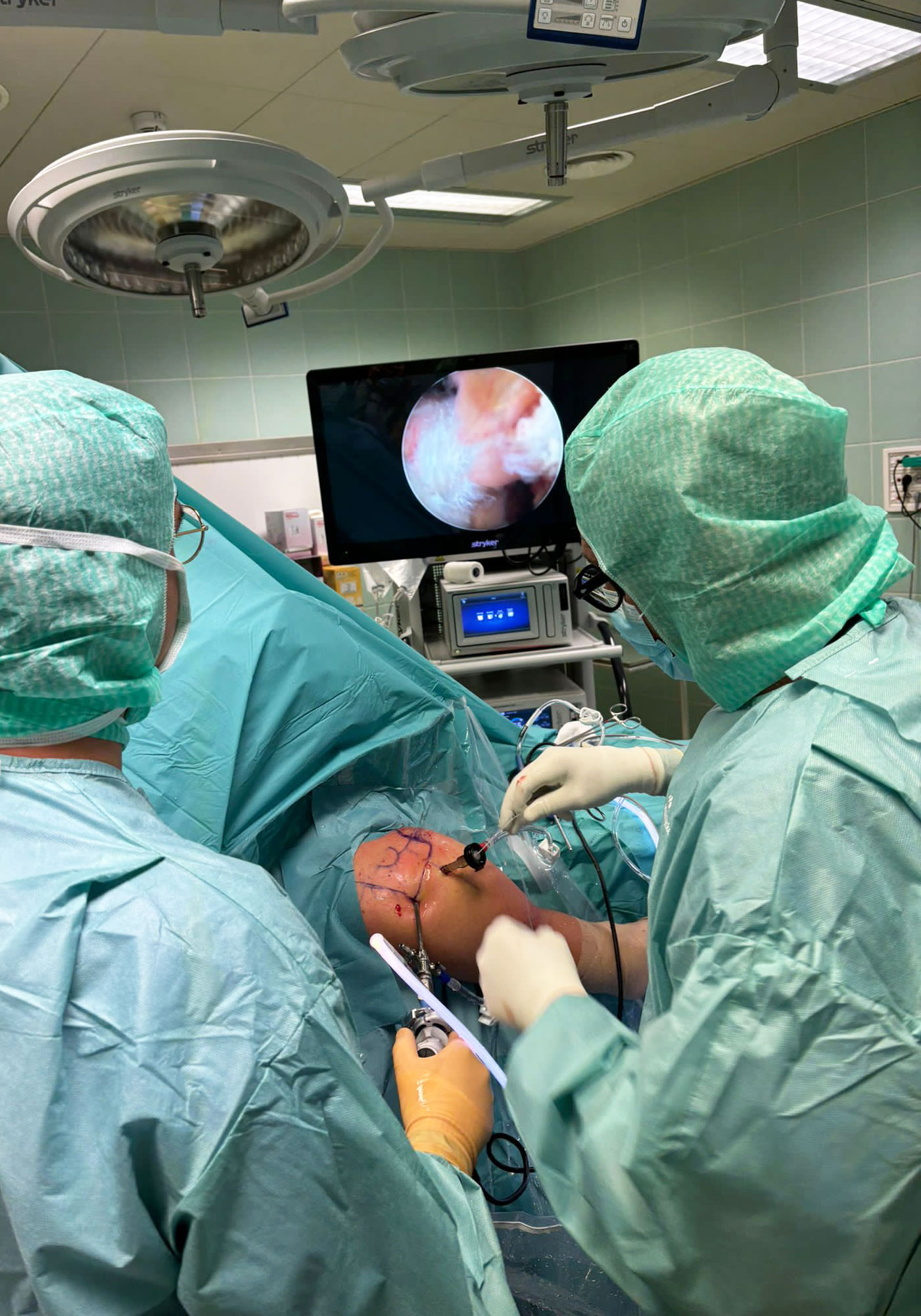 sala operatoria ginocchio
